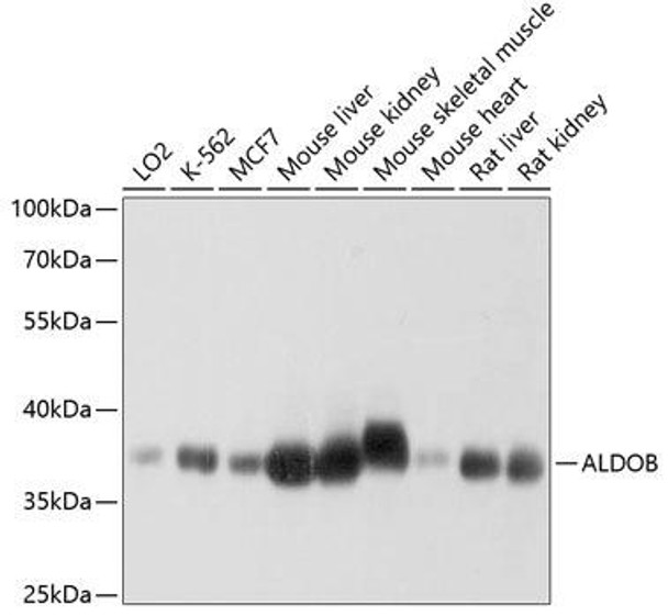 Metabolism Antibodies 2 Anti-ALDOB Antibody CAB3728