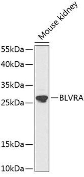 Cell Biology Antibodies 9 Anti-BLVRA Antibody CAB3765