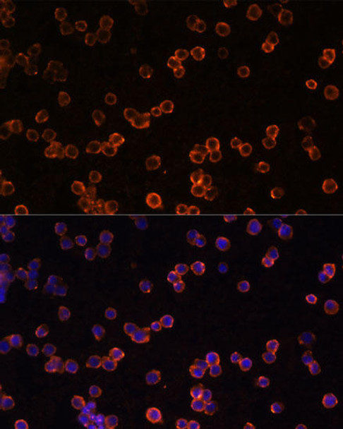 Cell Biology Antibodies 9 Anti-ENTPD1/CD39 Antibody CAB3778