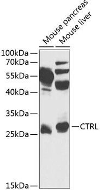 Cell Biology Antibodies 9 Anti-CTRL Antibody CAB3818