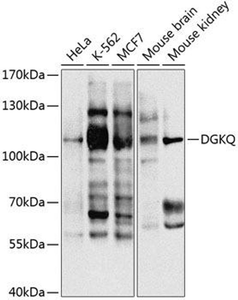 Cell Biology Antibodies 9 Anti-DGKQ Antibody CAB3825
