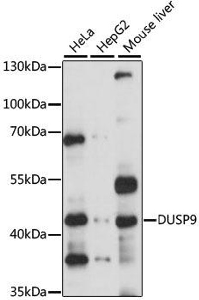 Cell Biology Antibodies 9 Anti-DUSP9 Antibody CAB3839