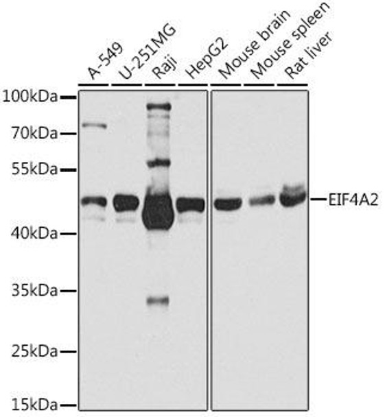 Immunology Antibodies 2 Anti-EIF4A2 Antibody CAB3849