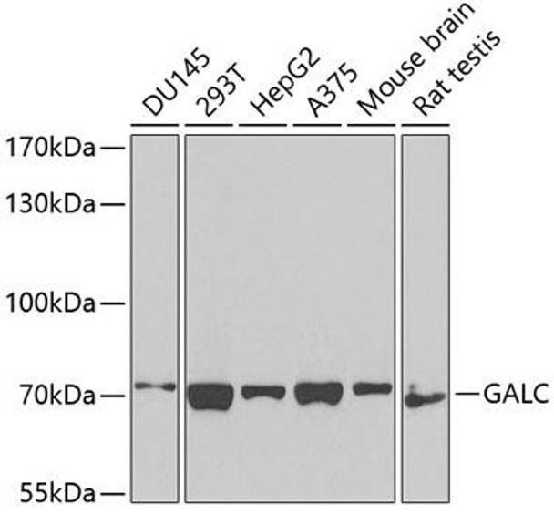 Metabolism Antibodies 2 Anti-GALC Antibody CAB3873