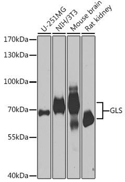 Cell Biology Antibodies 9 Anti-GLS Antibody CAB3885
