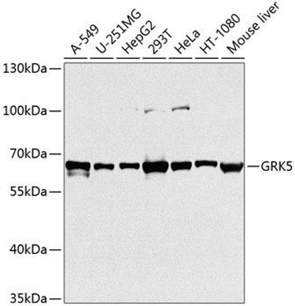 Cell Death Antibodies 2 Anti-GRK5 Antibody CAB3899