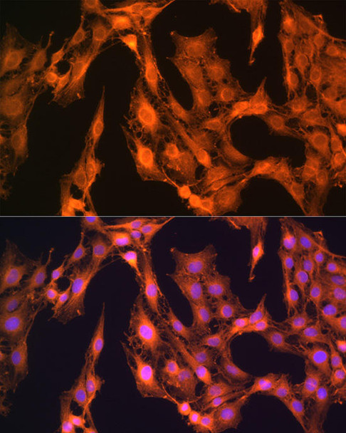 Signal Transduction Antibodies 2 Anti-LASP1 Antibody CAB3941