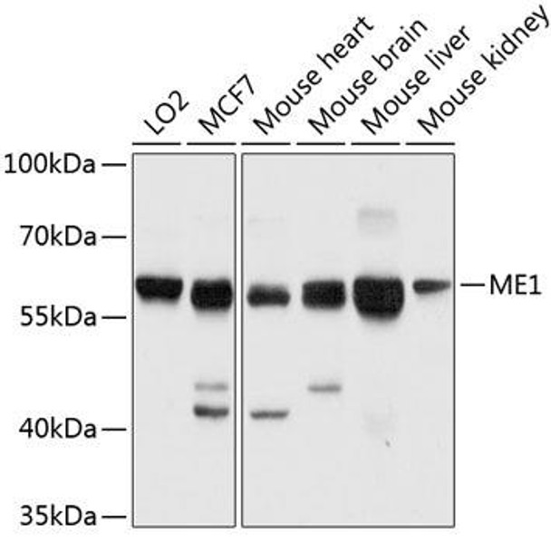 Cell Biology Antibodies 9 Anti-ME1 Antibody CAB3956