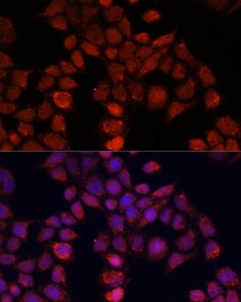 Immunology Antibodies 2 Anti-MOV10 Antibody CAB3966