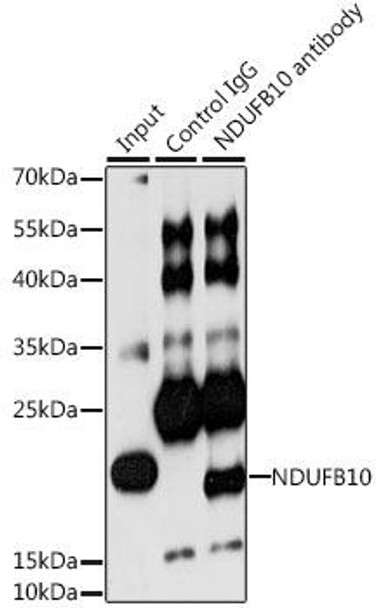 Cell Biology Antibodies 9 Anti-NDUFB10 Antibody CAB3982