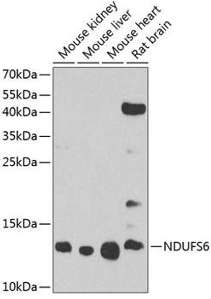 Cell Biology Antibodies 9 Anti-NDUFS6 Antibody CAB3985