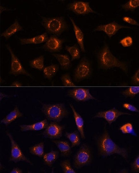 KO Validated Antibodies 1 Anti-NUCB1 Antibody CAB3994KO Validated