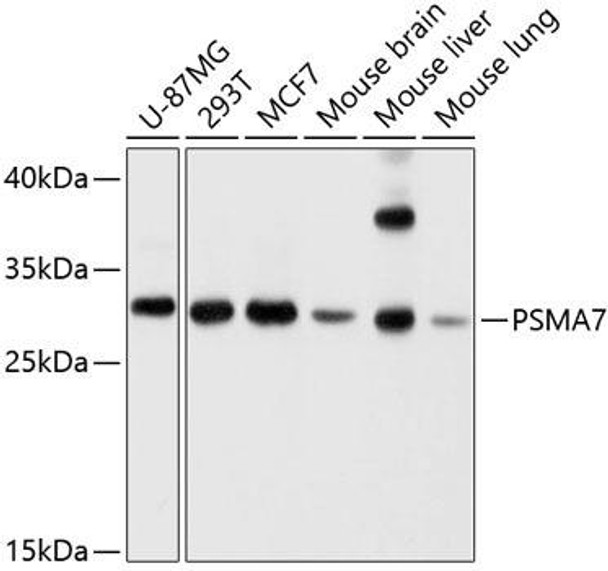 Immunology Antibodies 2 Anti-PSMA7 Antibody CAB4052