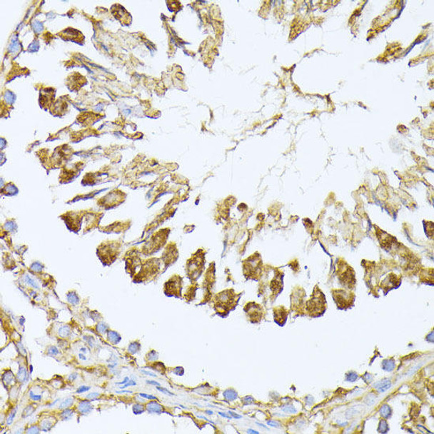 Immunology Antibodies 2 Anti-PSMA7 Antibody CAB4052