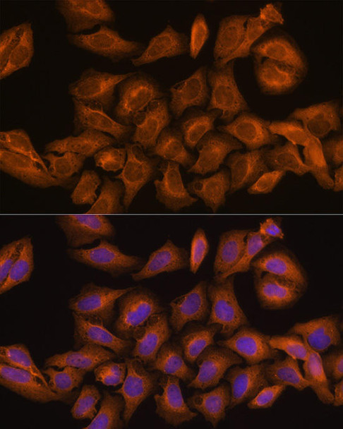 Cell Biology Antibodies 9 Anti-RNH1 Antibody CAB4079