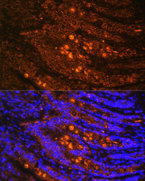 Immunology Antibodies 2 Anti-TLN1 Antibody CAB4158