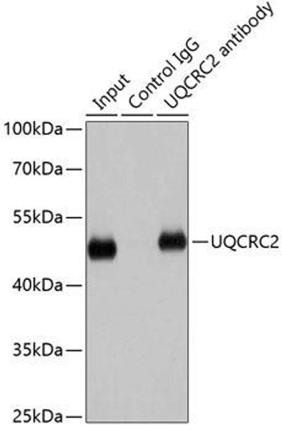 Cell Biology Antibodies 9 Anti-UQCRC2 Antibody CAB4181