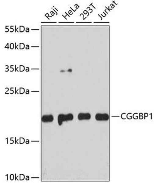 Epigenetics and Nuclear Signaling Antibodies 3 Anti-CGGBP1 Antibody CAB4231