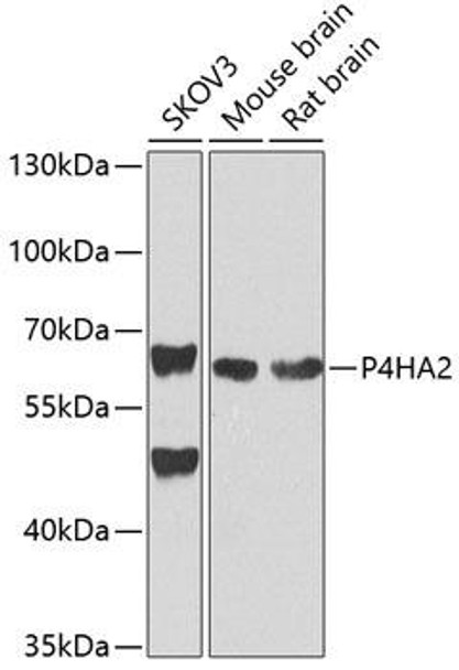 Cell Biology Antibodies 9 Anti-P4HA2 Antibody CAB4262