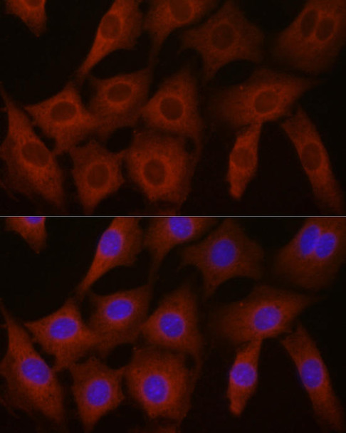 Metabolism Antibodies 2 Anti-EIF4E2 Antibody CAB4305