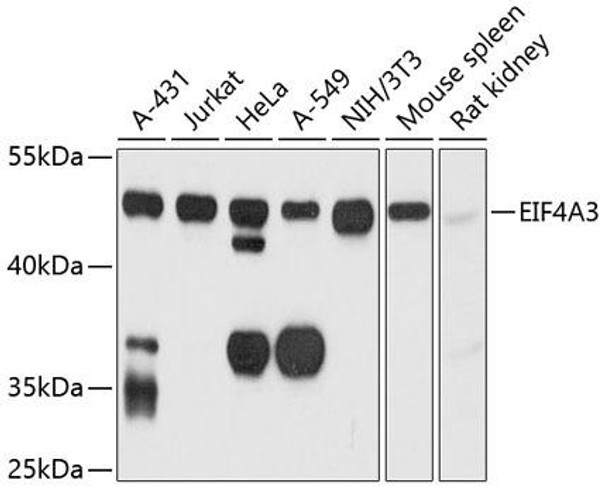 Epigenetics and Nuclear Signaling Antibodies 3 Anti-EIF4A3 Antibody CAB4338