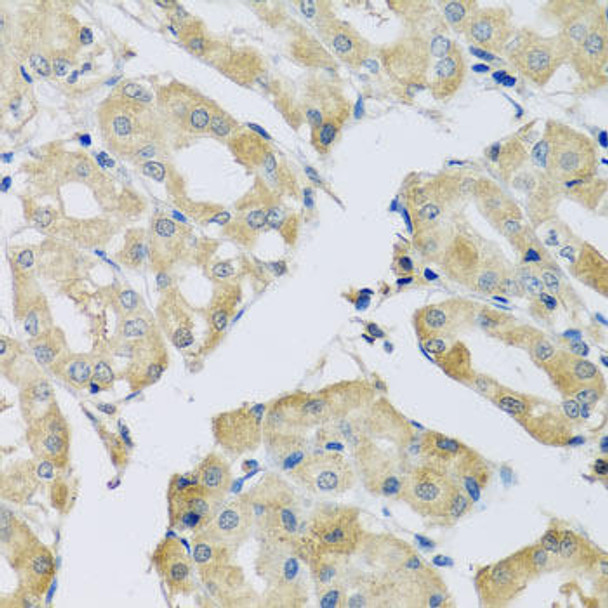 Cell Biology Antibodies 9 Anti-ABCF2 Antibody CAB4365