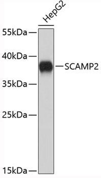 Cell Biology Antibodies 9 Anti-SCAMP2 Antibody CAB4367