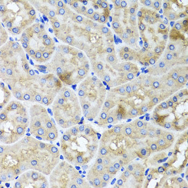 Cell Biology Antibodies 16 Anti-USH1C Antibody CAB4368