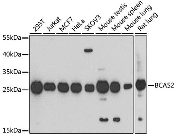 Epigenetics and Nuclear Signaling Antibodies 3 Anti-BCAS2 Antibody CAB4398