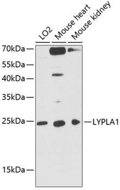 Metabolism Antibodies 2 Anti-LYPLA1 Antibody CAB4419