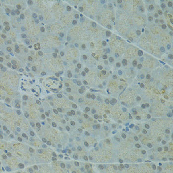 Immunology Antibodies 2 Anti-IVNS1ABP Antibody CAB4442