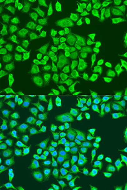 Epigenetics and Nuclear Signaling Antibodies 3 Anti-IGF2BP3 Antibody CAB4444