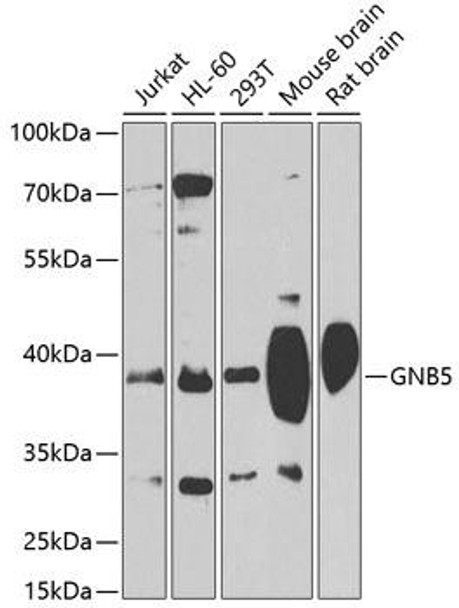 Cell Biology Antibodies 9 Anti-GNB5 Antibody CAB4447