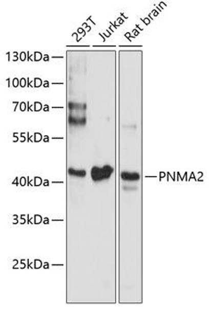 Cell Biology Antibodies 9 Anti-PNMA2 Antibody CAB4448