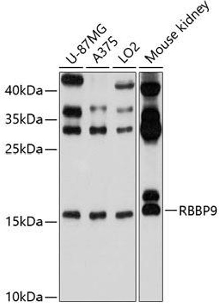 Cell Biology Antibodies 9 Anti-RBBP9 Antibody CAB4451