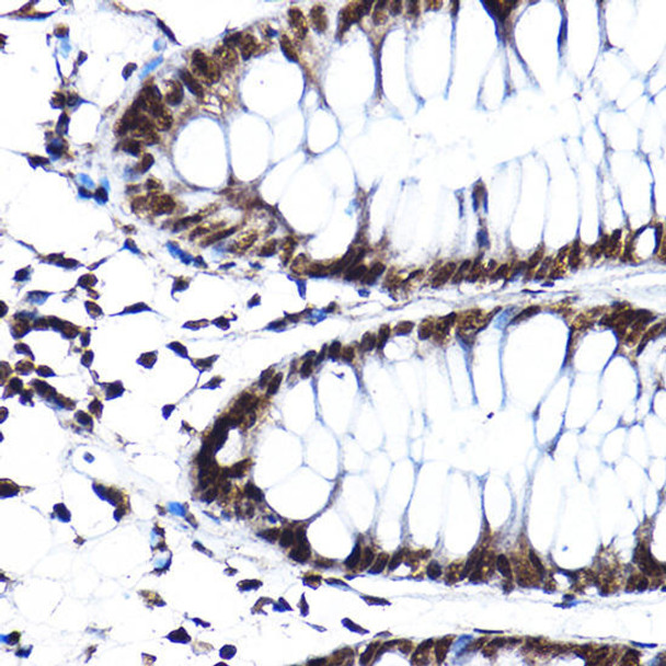 Epigenetics and Nuclear Signaling Antibodies 3 Anti-SF3A3 Antibody CAB4465