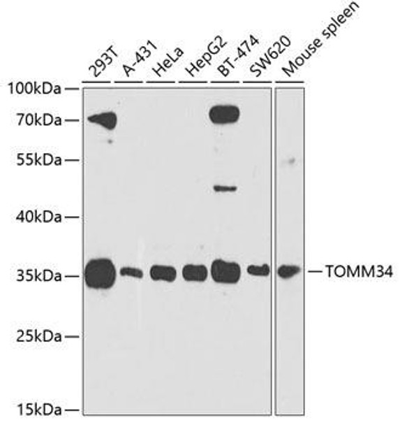Cell Biology Antibodies 9 Anti-TOMM34 Antibody CAB4467