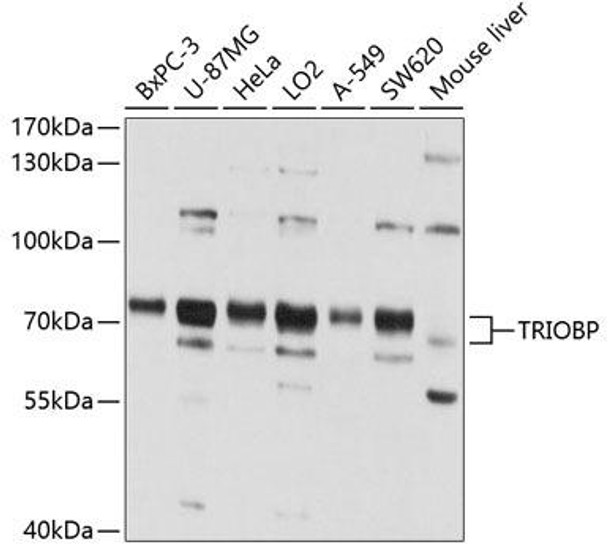 Cell Cycle Antibodies 1 Anti-TRIOBP Antibody CAB4485