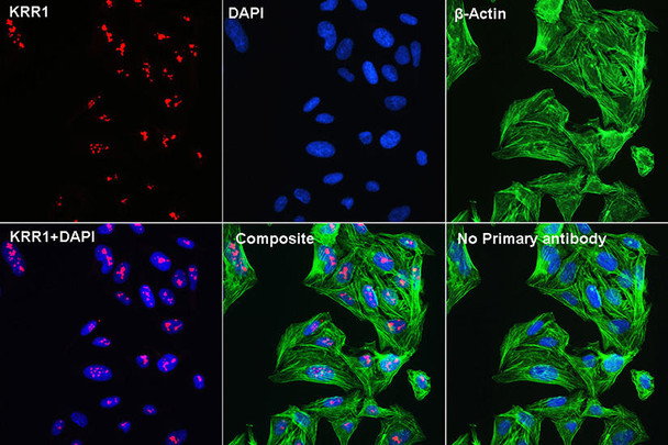 Cell Biology Antibodies 9 Anti-KRR1 Antibody CAB4487