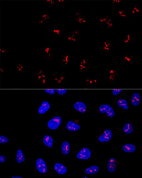 Cell Biology Antibodies 9 Anti-KRR1 Antibody CAB4487