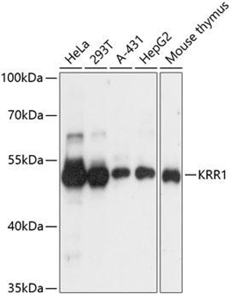 Cell Biology Antibodies 9 Anti-KRR1 Antibody CAB4487