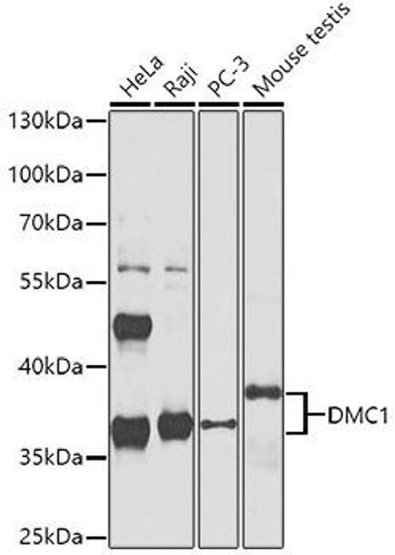 Cell Cycle Antibodies 1 Anti-DMC1 Antibody CAB4491