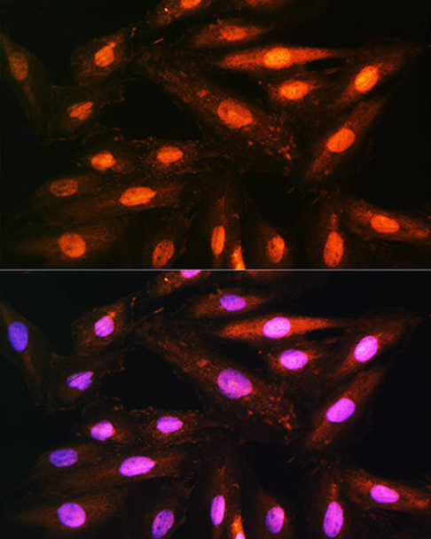 Cell Biology Antibodies 9 Anti-KIFAP3 Antibody CAB4518