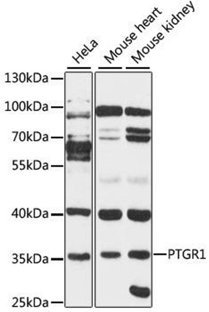 Immunology Antibodies 2 Anti-PTGR1 Antibody CAB4521