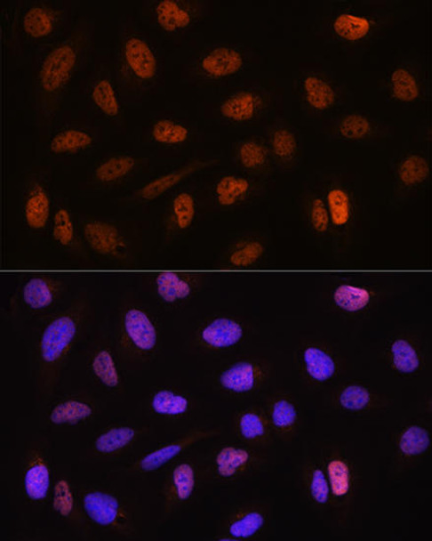 Epigenetics and Nuclear Signaling Antibodies 3 Anti-CSTF2T Antibody CAB4540