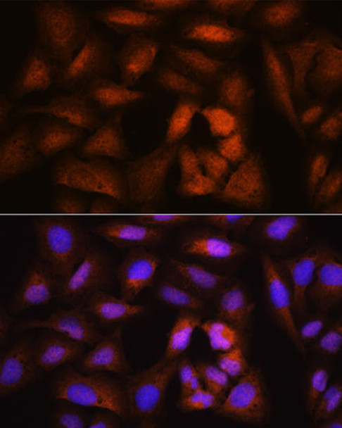 Cell Cycle Antibodies 1 Anti-NCAPH Antibody CAB4548