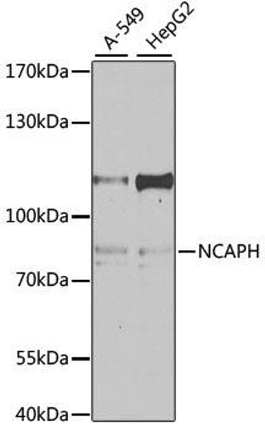 Cell Cycle Antibodies 1 Anti-NCAPH Antibody CAB4548