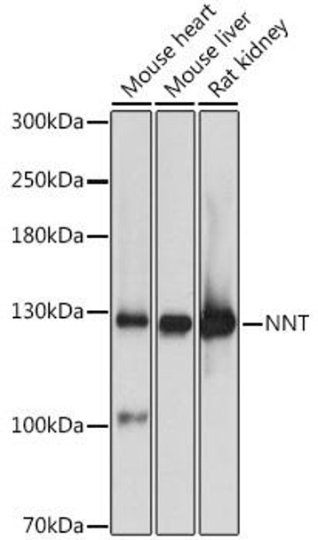 Cell Biology Antibodies 9 Anti-NNT Antibody CAB4561