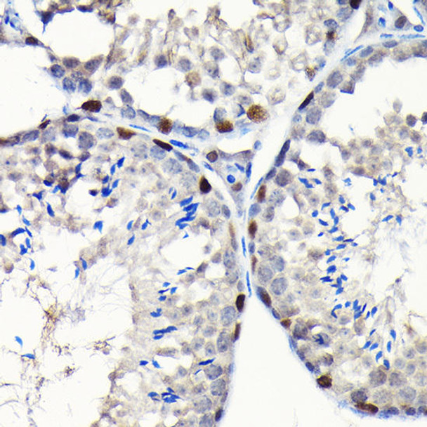 Cell Biology Antibodies 9 Anti-GTPBP4 Antibody CAB4565