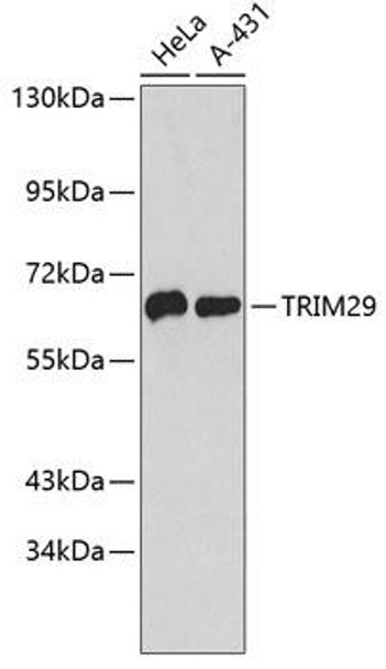 Immunology Antibodies 2 Anti-TRIM29 Antibody CAB4576